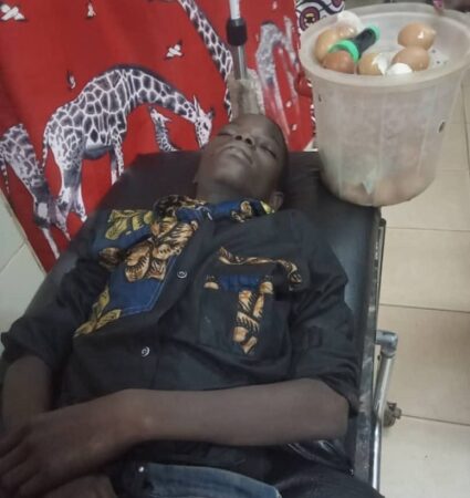 Le jeune vendeur des œufs cuits électrocuté par un poteau de l'ENERCA en plein centre-ville de Bangui à l'hôpital avec son sceau des œufs
