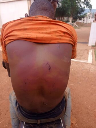 Le dos de l'une des deux victimes des soldats du BIR torturés dans le quartier Fodé, dans le troisième arrondissement de Bangui. Photo CNC