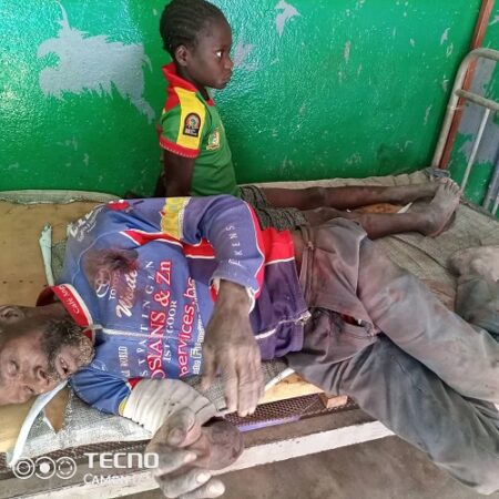 Des blessés dans l'attaque du village Nzakoundou le 22 mars 2022
