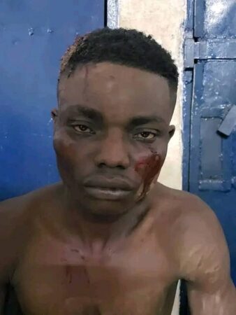 Homme blessé au visage assis en détention