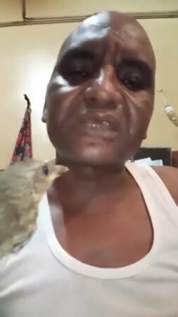 Un malade dans sa chambre de l'hôpital communautaire avec l'oiseau qu'il a capturé à la main