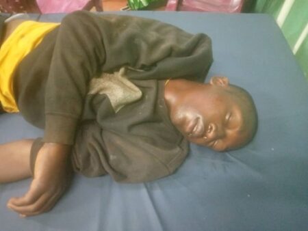 Le jeune conducteur de taxi-moto, monsieur Issène Ali, inconscient sur le lit d'hôpital communautaire à Bangui