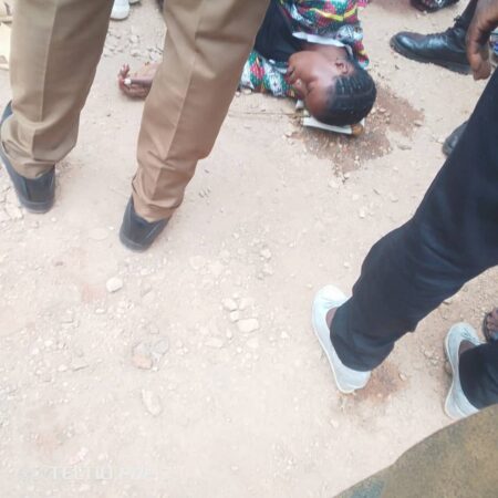 La jeune fille blessée accidentellement à l'aéroport de Bangui Mpoko lors des travaux d'amenagement le 1 octobre 2025. Photo CNC