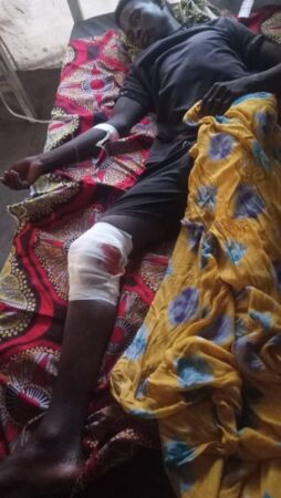 L'un des deux blessés d'attaque des bandits soudanais à 15 kilomètres d'Amdafock, dans la préfecture de la Vakaga, au nord de la RCA