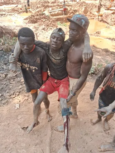 Ndachima : un jeune ouvrier centrafricain grièvement blessé par balle par un gendarme centrafricain