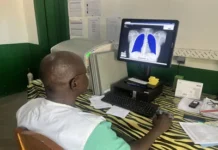 Centrafrique : à Batangafo, MSF utilise l’intelligence artificielle pour détecter plus rapidement la tuberculose Centrafrique : à Batangafo, MSF utilise l’intelligence artificielle pour détecter plus rapidement la tuberculose